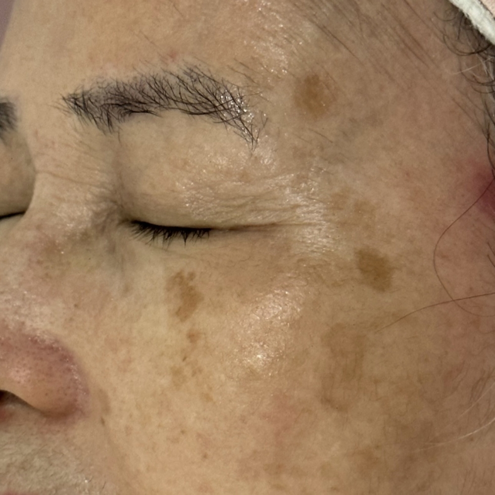 Instant Anti Aging