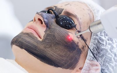 Pico Laser Carbon Peel                                             (APPOINTMENT:  012-9288698 )